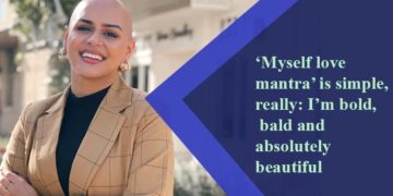 ‘I am bald women with Alopecia & yes I am stunning’ 